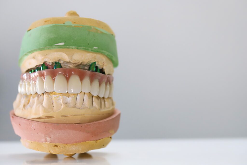 all-on-x dentures Augustine