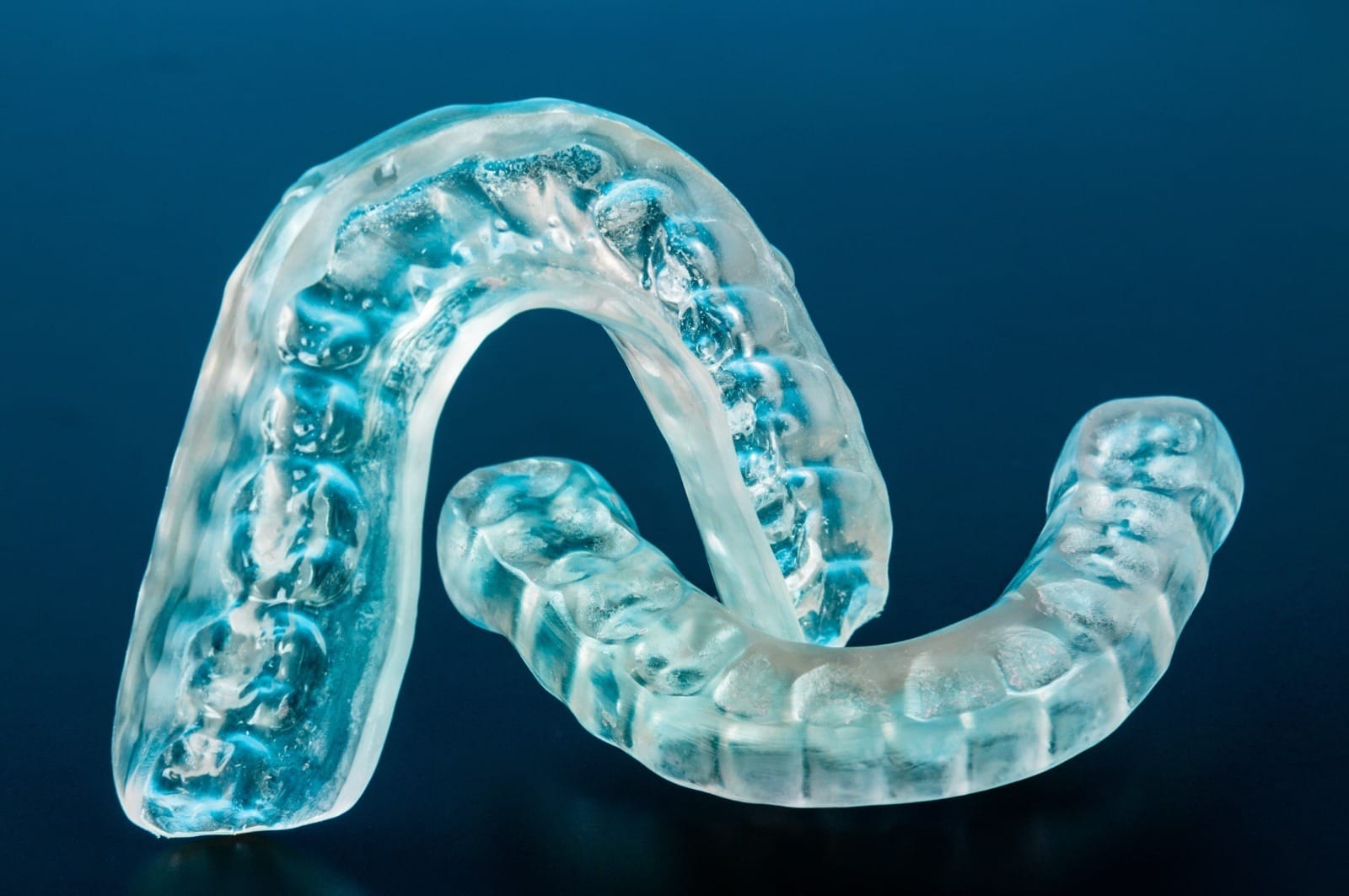 Dental splint to prevent bruxism