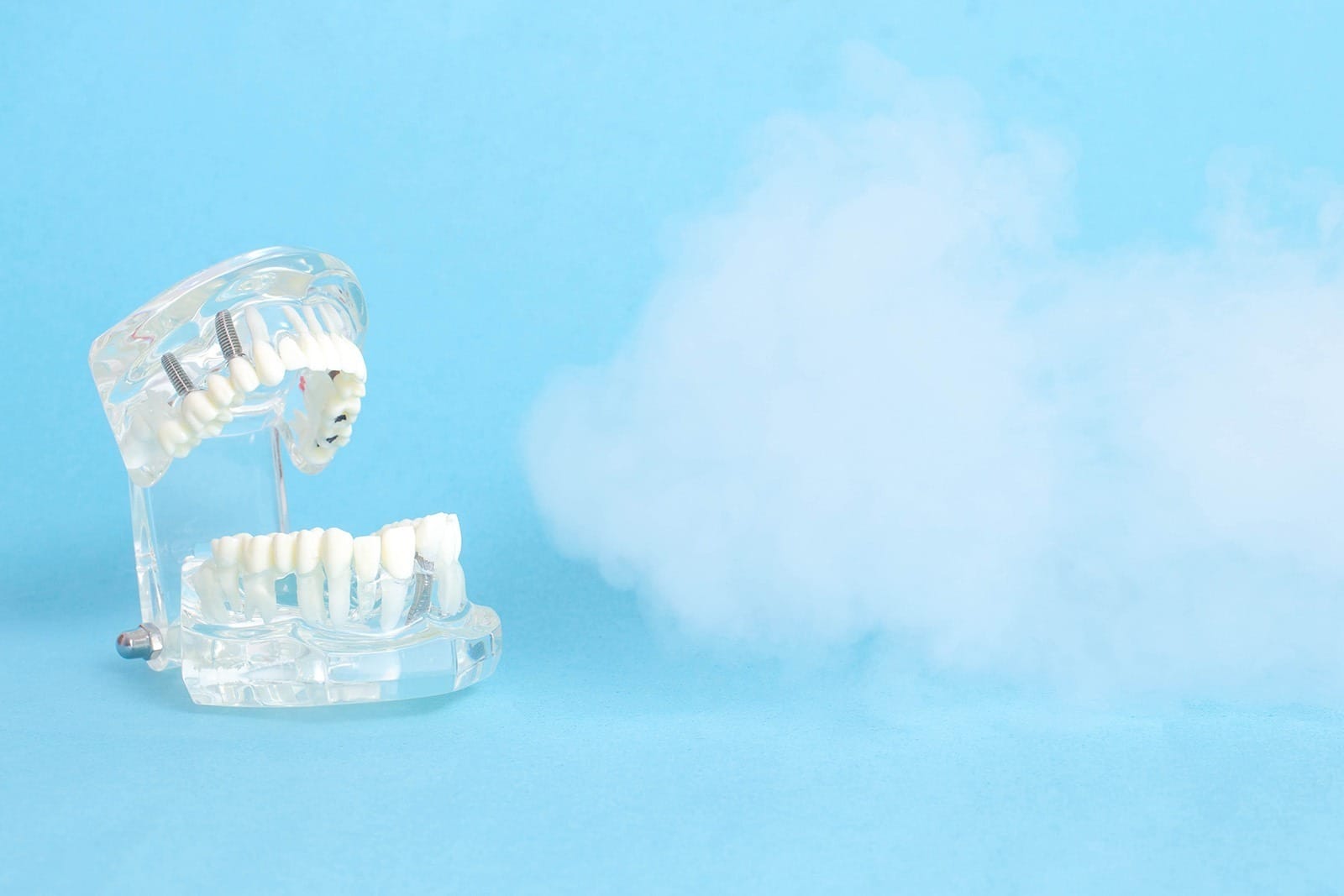 Dental jaw model on a blue background with ozone