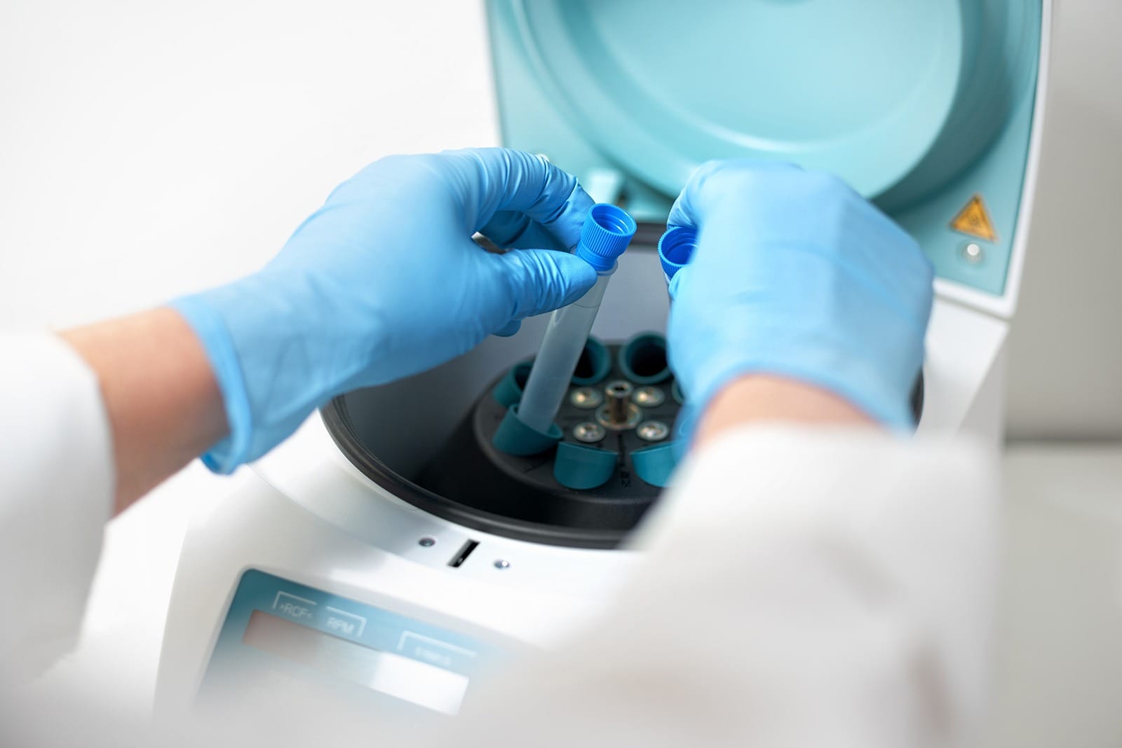 PRF treatment tubes and machine