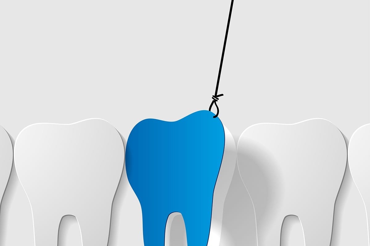 Pulled tooth